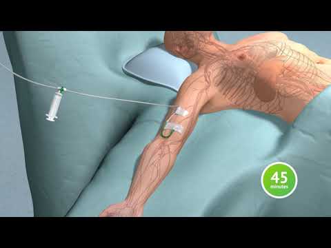 3D Animation Visualization of Fluorescence Guided Imaging in Laparoscopic Cholecystectomy