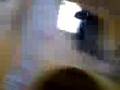 Hospital del torax video niño