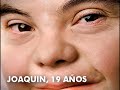 Down syndrome:&nbsp;D�a Mundial del s�ndrome de Down 2012