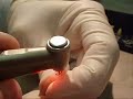 Ideal Access Preparation of a Mandibular Canine Ideal Access Preparation of a Mandibular Canine