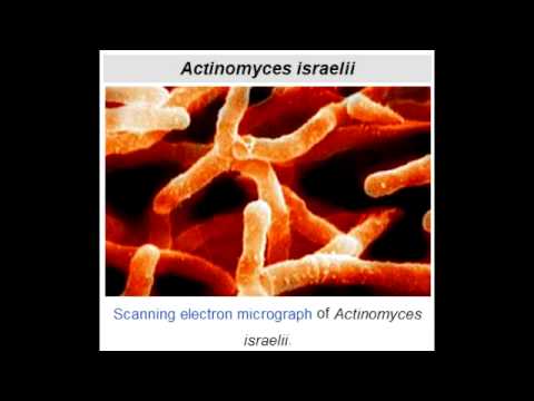 how to isolate actinomycetes
