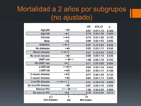 Revascularización de vaso culpable vs múltiples vasos. Dr. Pablo Rivara. Residencia de Cardiología. Hospital C. Argerich. Buenos Aires