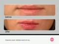 LipFusion Sexy and Flush Full Out Pout Duo - Item: 224-554