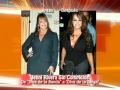 Cirugias de las Famosas - Antes y Después en SuperLatina