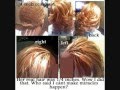 all types of braids