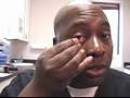 How to Put In Contact Lenses : Using Your Fingers When Removing Contact Lenses