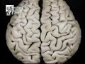 El cerebro de Albert Einstein (II de II)