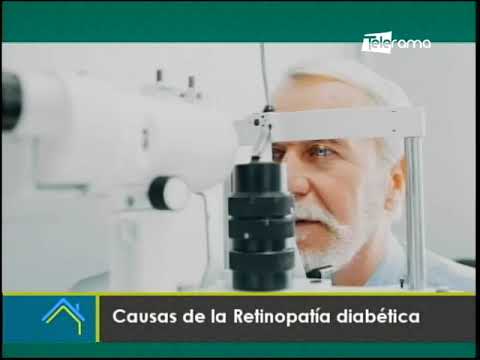 Causas de la retinopatía diabética