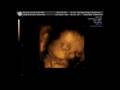 videos de 3D Sonogram Baby Zoey