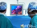 Laparoscopic Gastric Bypass and Sleeve Gastrectomy Surgery