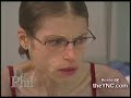 Worst Case of Anorexia Worst Case of Anorexia