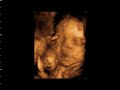 Baby 4D Smile