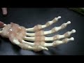 Tendons of the Forearm
