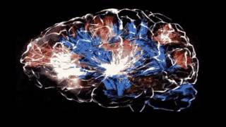 Esperanza para enfermos de ELA desarrollada en Chile