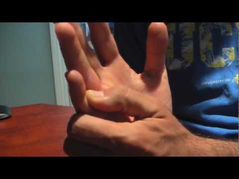 how to fix jammed finger