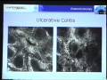 videos de Confocal Endomicroscopy, Dr. M. Goetz