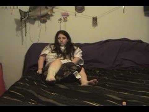 Crystal's Sprain