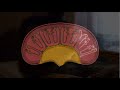 Feline Kidney Disease/Ch2 -Understanding Kidney Disease 2