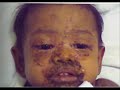 This Baby Needs Your Help