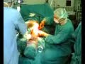 Op.Dr.�mit KORKMAZ Ameliyat Videosu