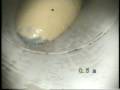 Video screenshot