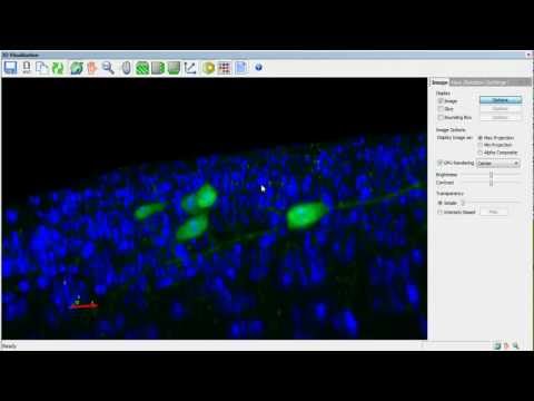 MBF Bioscience – Stereology with Stereo Investigator