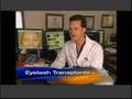 CBS-Early-Show-Eyela