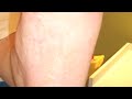 The Foot Spot - Podiatric Education Consultants