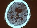 CT of Huntington\