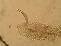 Dactylogyrus parasite on the gills of a Sand shiner: Part 2