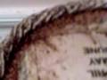 Employer's Right To Send Home Employee With Bedbugs