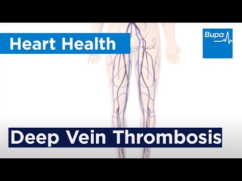 VARICOSE VEIN BLOOD CLOT SYMPTOMS – SITE rioublacenby