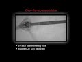 Rage broadheads in slow motion