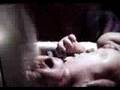 Fecundación- Embarazo- Reproducion humana -El cerebro.