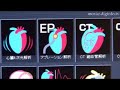 High Speed, High Precision 3D Diagnostic Imaging Analysis Eq Diagnostic Imaging