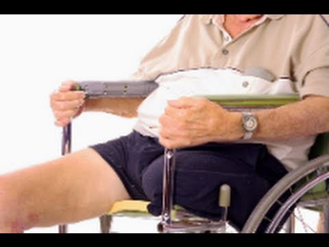 how to relieve phantom limb pain
