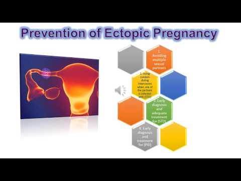 how to treat ectopic pregnancy