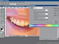 Photoshop retouching: Teeth whitening Photoshop retouching: Teeth whitening