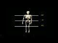Forex Fibonacci Analysis Video 1 Forex Fibonacci Analysis Video 1