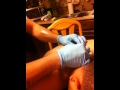 Inhouse cyst surgery