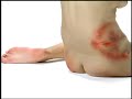 Sernam Cuerpos golpeados