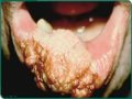Drogas e suas deformações - imagens fortes