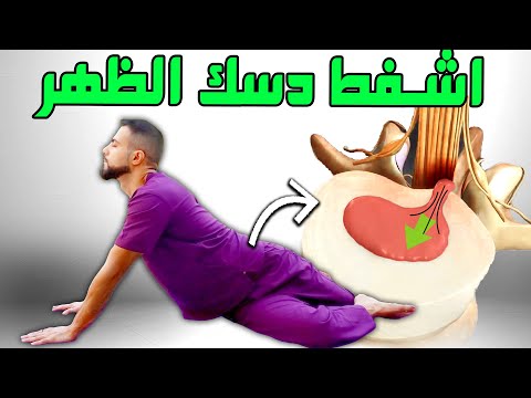 يمكن علاج ديسك أسفل الظهر بنسبه 96% بـ4 خطوات فقط | لا جراحه بعد اليوم