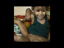 Octopus Girl Lakshim had 8 Limbs in Surgery..