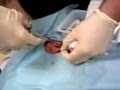 videos de Axe-hole in my leg - Take 1