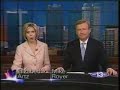 Radiesse News Segment Radiesse News Segment