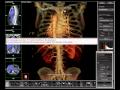 Tips &amp; Tricks Video: Creating a Series of a Rotating 3D Volume
