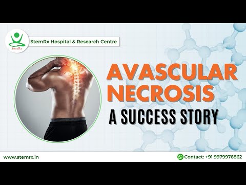 how to cure avascular necrosis