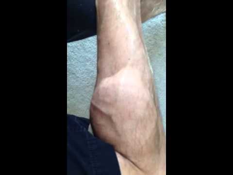 how to relieve twitching legs
