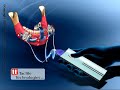 3D medical animation Virtual Point